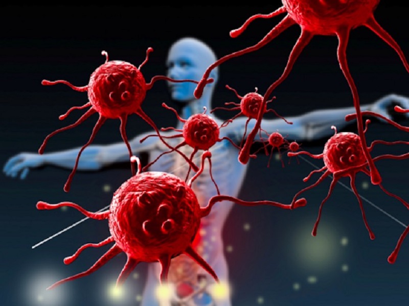 I tumori intrinseci del ponte sono neoplasie molto aggressive ancora difficili da curare. Dalla ricerca preclinica arriva però una terapia che potrebbe essere promettente