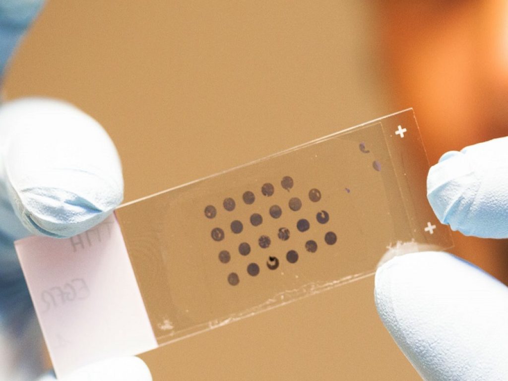 Negli Stati Uniti generati organoidi che riproducono la complessità della pelle umana partendo da cellule staminali pluripotenti umaneanno cerebrale ipossico/ischemico: la risonanza magnetica potrebbe identificare le lesioni  trattabili