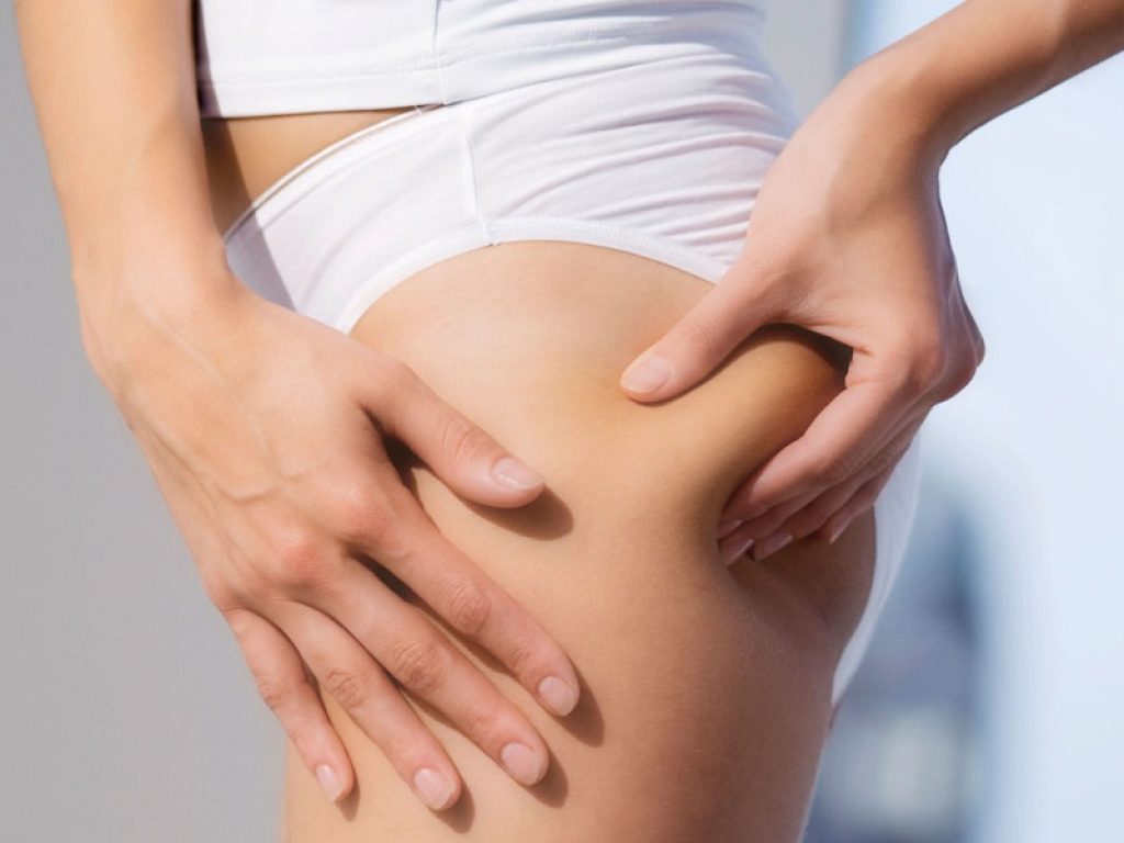 Cellulite: contro la "buccia d'arancia" arriva in Italia dagli Stati Uniti Cellfina, il trattamento che offre risultati che durano fino a 5 anni