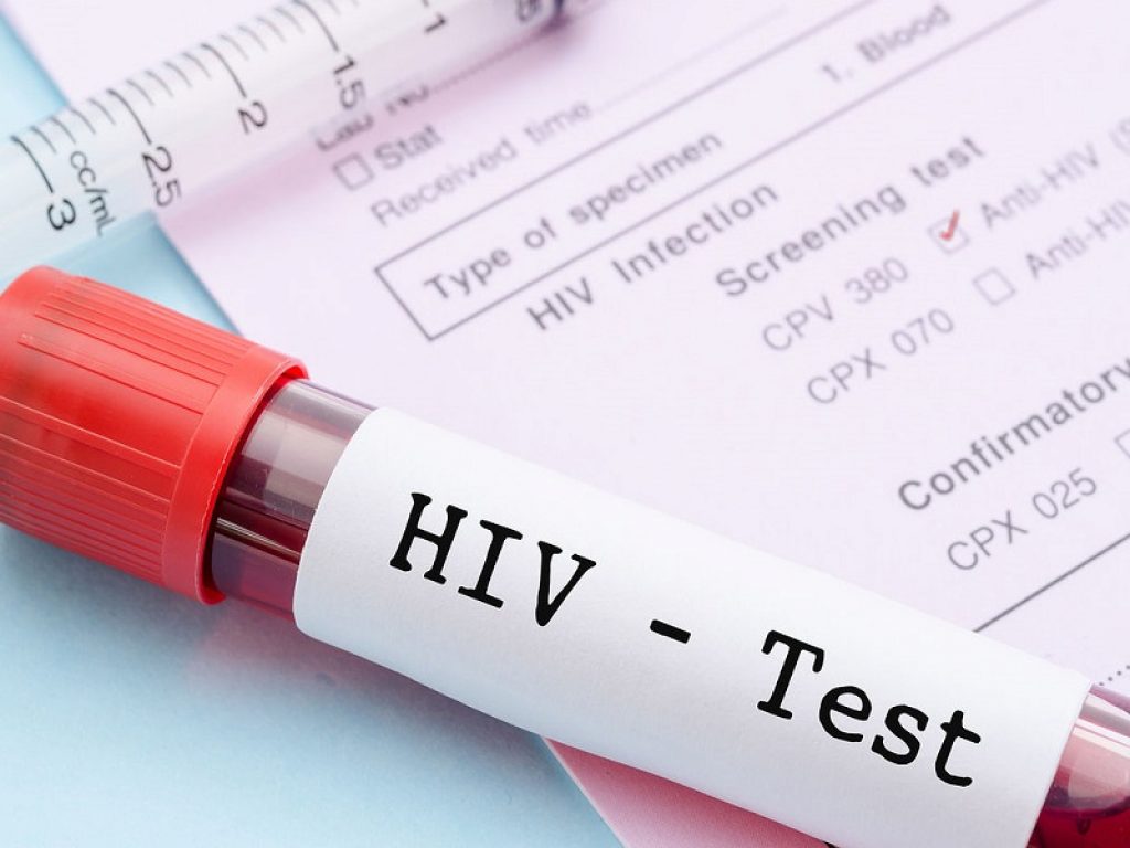 HIV: nei pazienti bassa conta dei CD4, il regime BIC/FTC/TAF è risultato efficace sia in prima che in seconda linea secondo un nuovo studio