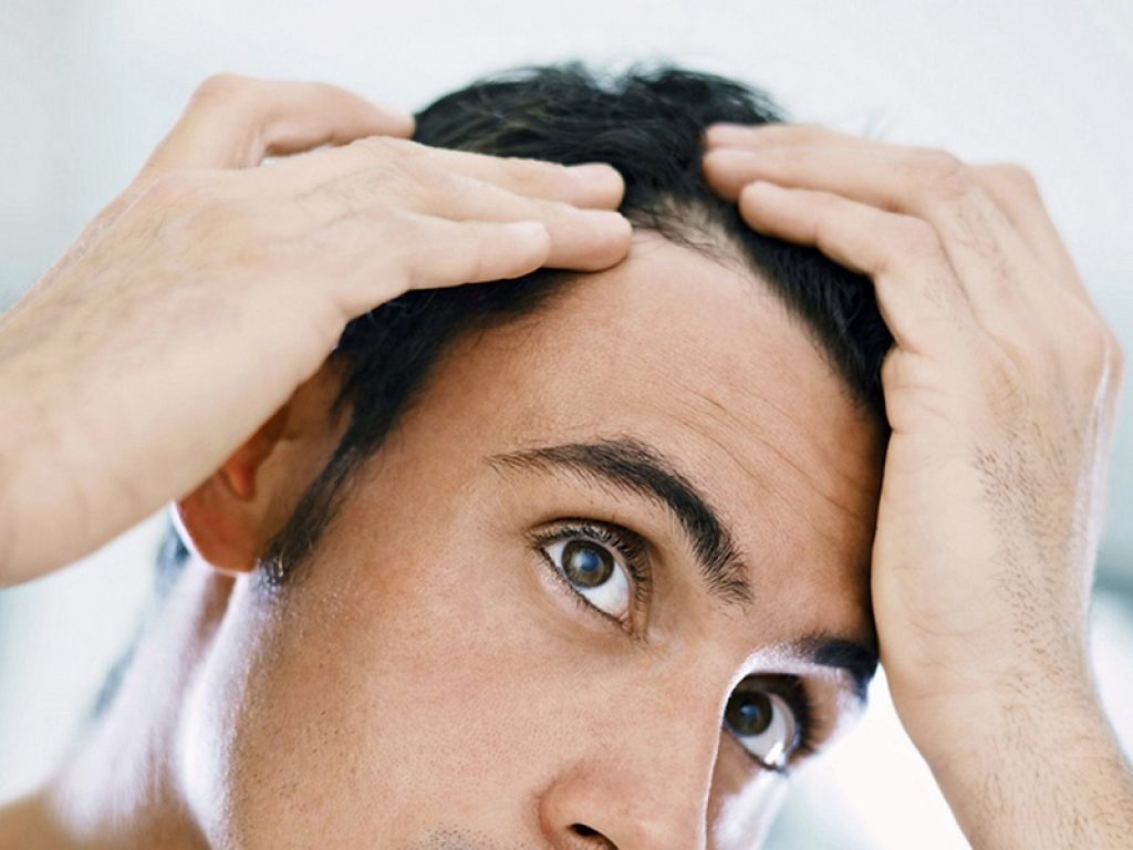 Le cause della caduta dei capelli negli uomini: può dipendere da fattori genetici o ormonali ma anche da disfunzioni della tiroide, alterazioni del sistema immunitario e carenze alimentari