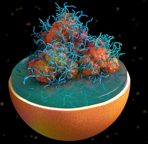 Malattia di Fabry: gli effetti benefici della terapia enzimatica su cuore e reni. I pazienti sono rimasti stabili durante 10 anni di trattamento