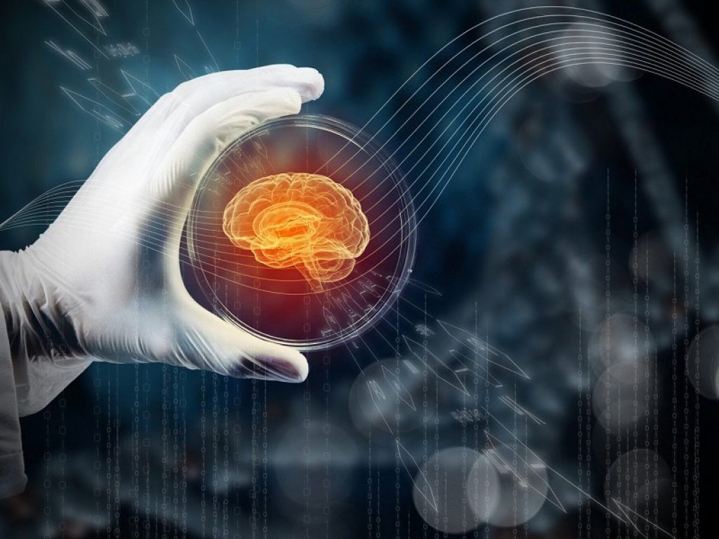 sindrome di dravet nuovi farmaci epilessia