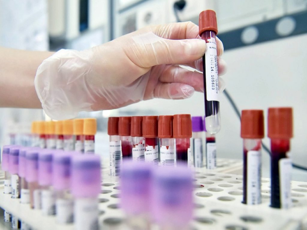 AIFA dispone il divieto di utilizzo lotti medicinali plasmaderivati delle ditte Kedrion S.p.A. e Biotest Italia S.r.l.