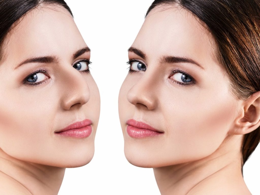 Dalla rinoplastica all'ombelicoplastica, cresce tra gli italiani la passione per il ritocchino, possibilmente mini-invasivo, senza effetti collaterali e con risultati naturali. I trend della chirurgia plastica