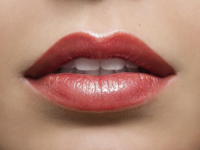 Per avere labbra carnose e sensuali è boom di protesi labiali, piccoli cuscinetti in silicone duro non soggetti a degradazione o rottura e rimovibili.