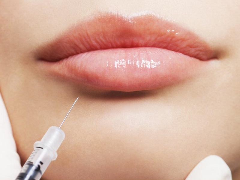 Chirurgia estetica, boom di interventi negli ultimi mesi. L'avvocato Marzorati: "In aumento anche la richiesta di ritocchi correttivi"