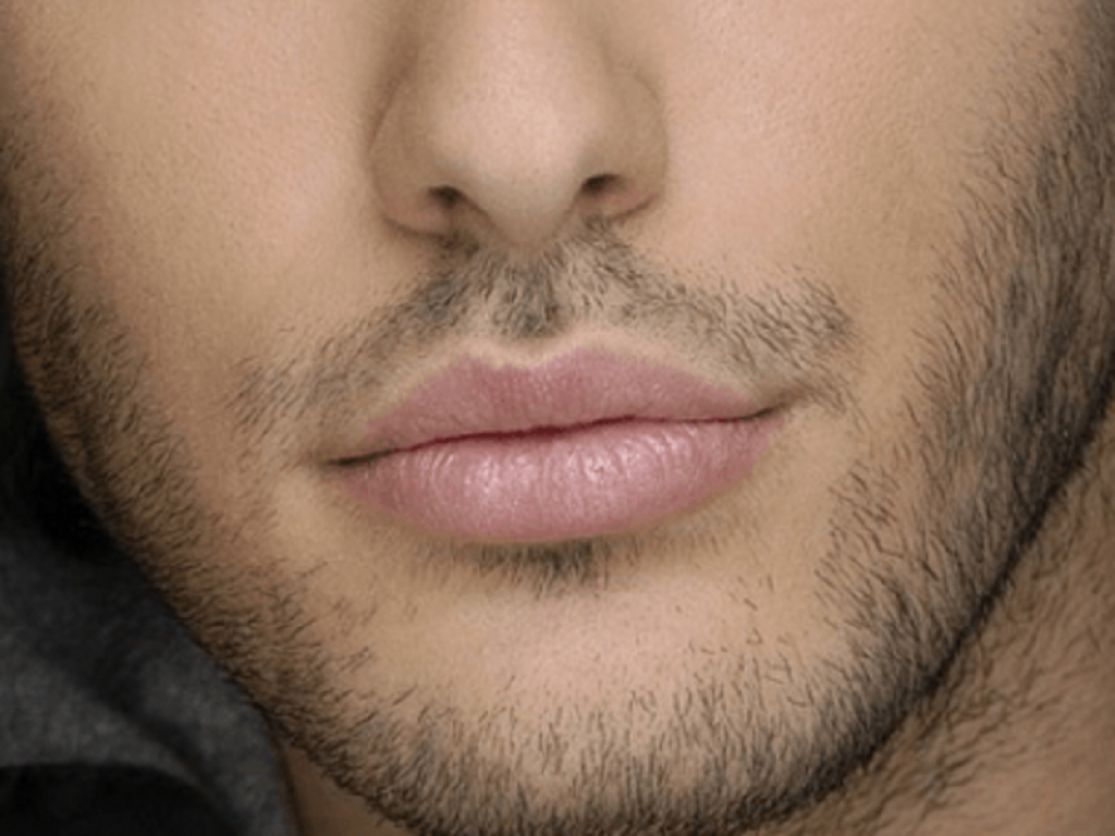 La tendenza arriva da Oltreoceano, dove negli ultimi anni gli interventi maschili alle labbra sono aumentati del 400%. Anche in Italia sono sempre di più gli uomini che si sottopongono ad una seduta di riempitivo di acido ialuronico