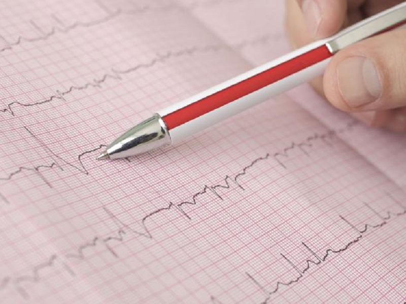 Fibrillazione atriale: il passaggio da apixaban a rivaroxaban è associato a un rischio maggiore di ictus/embolia sistemica e di emorragia maggiore