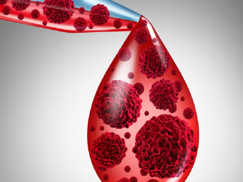 La Commissione Europea ha approvato in via condizionata talquetamab per il trattamento di alcuni adulti affetti da mieloma multiplo recidivato e refrattario