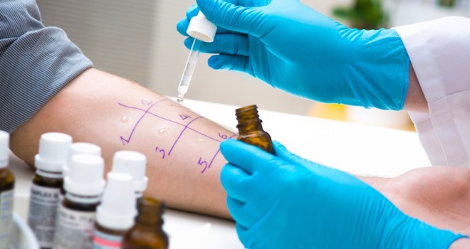 allergie alimentari immunoterapia orale