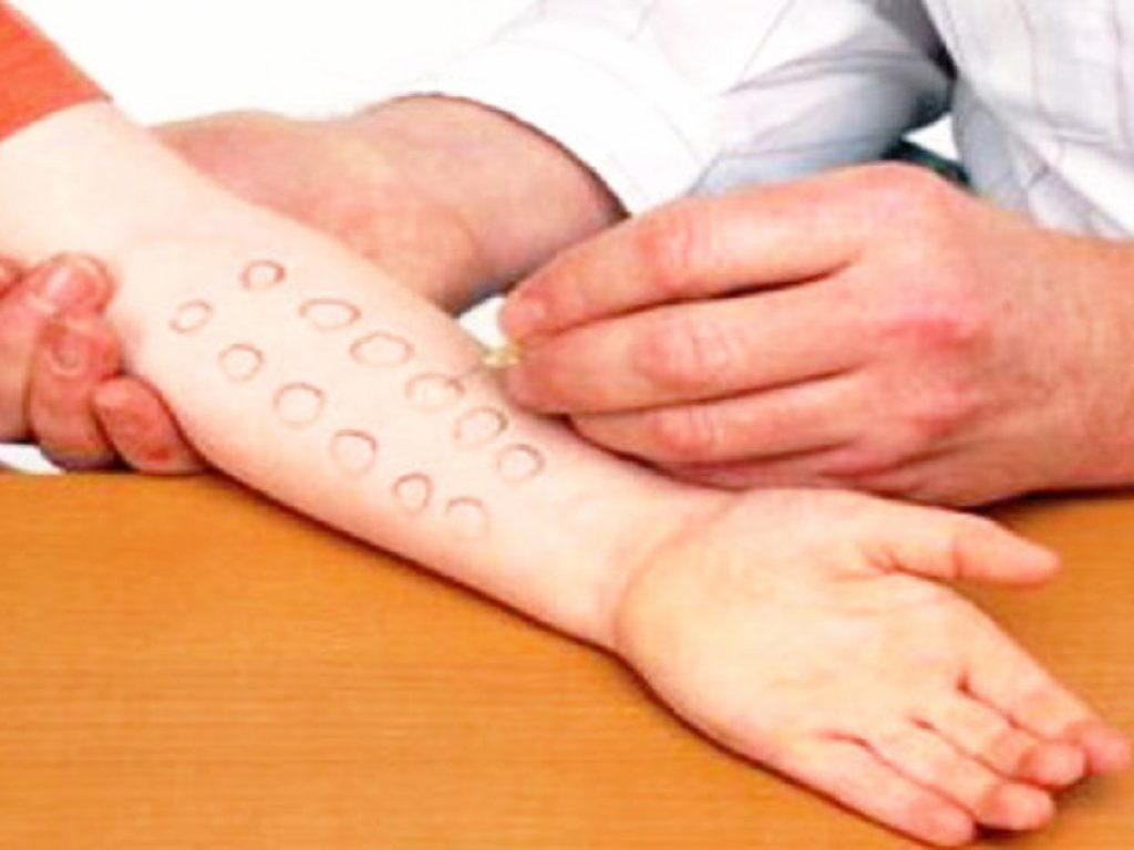 Allergia e intolleranza alimentare indicanouna reazione indesiderata del nostro organismo a contatto con una determinata sostanza ma ci sono delle differenze