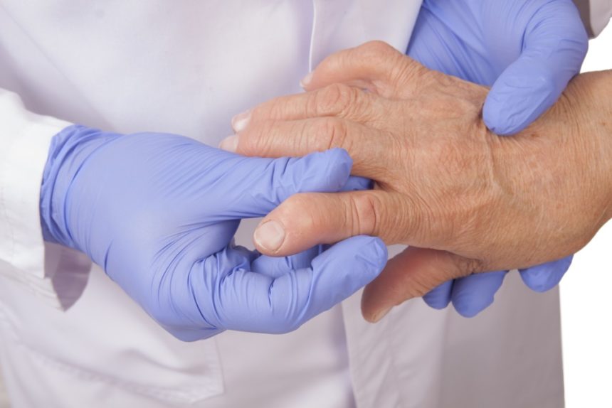 Artrite reumatoide: livelli sierici IL-6 predicono risposta a sarilumab secondo uno studio pubblicato su Arthritis & Rheumatology