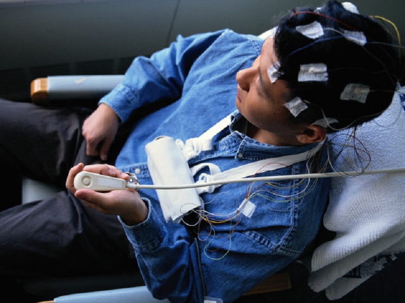 L'aggiunta di cenobamato è risultata sicura e ha ridotto le convulsioni in oltre il 90% dei pazienti epilettici adulti con convulsioni focali non controllate