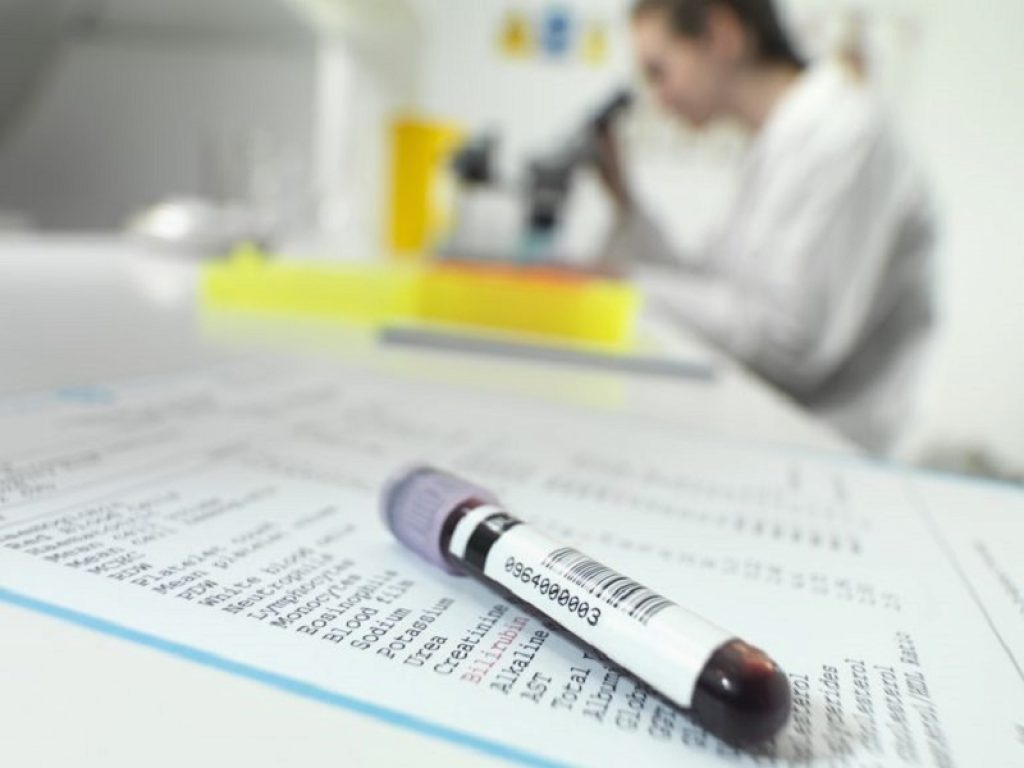 Raccomandata in UE l'approvazione di momelotinib per il trattamento di pazienti con anemia da moderata a grave