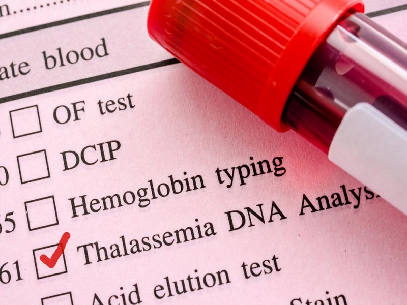 Sì a exagamglogene autotemcel [exa-cel], la prima terapia di editing genico basata su CRISPR/Cas9 per il trattamento della beta-talassemia dipendente dalle trasfusioni