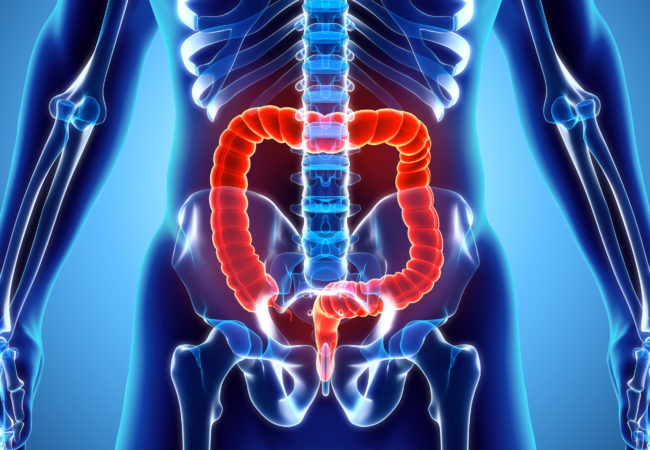 Tumore colorettale metastatico refrattario: via libera del CHMP dell'EMA per la combinazione trifluridina/tipiracil più bevacizumab