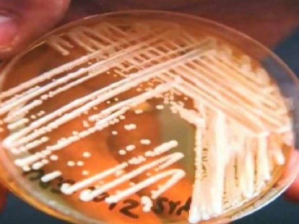 La Candida auris resiste ai farmaci e al caldo: con il surriscaldamento del pianeta gli esperti lanciano l'allarme per nuove infezioni