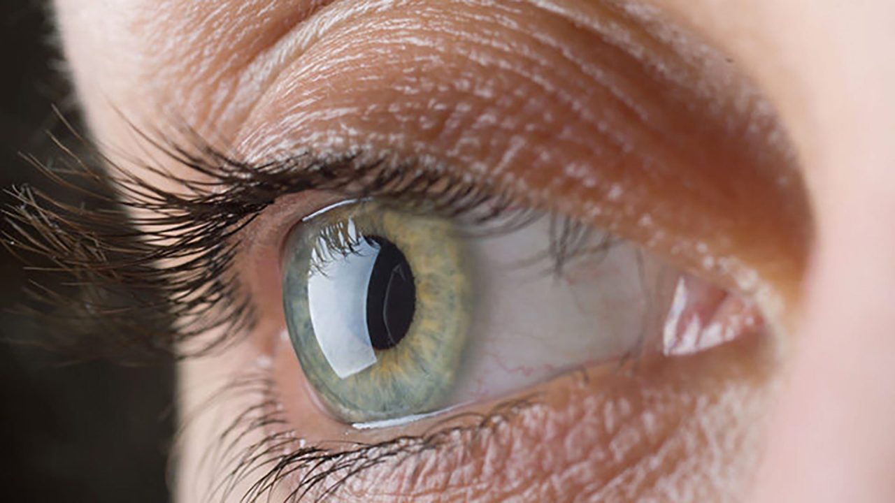 Occhio secco: arriva Arianna, la APP che rende più facile la cura. E' il primo strumento mai realizzato fino ad ora per monitorare in remoto la malattia