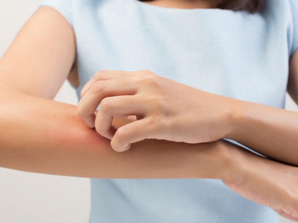 Consensus italiana sulla gestione della psoriasi pediatrica moderata/severa pubblicata sulla rivista Dermatology and Therapy.