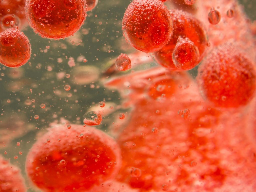 Trombocitopenia immunologica: cortisone e asportazione della milza sono le prime cure, ma da poco tempo è disponibile anche un farmaco