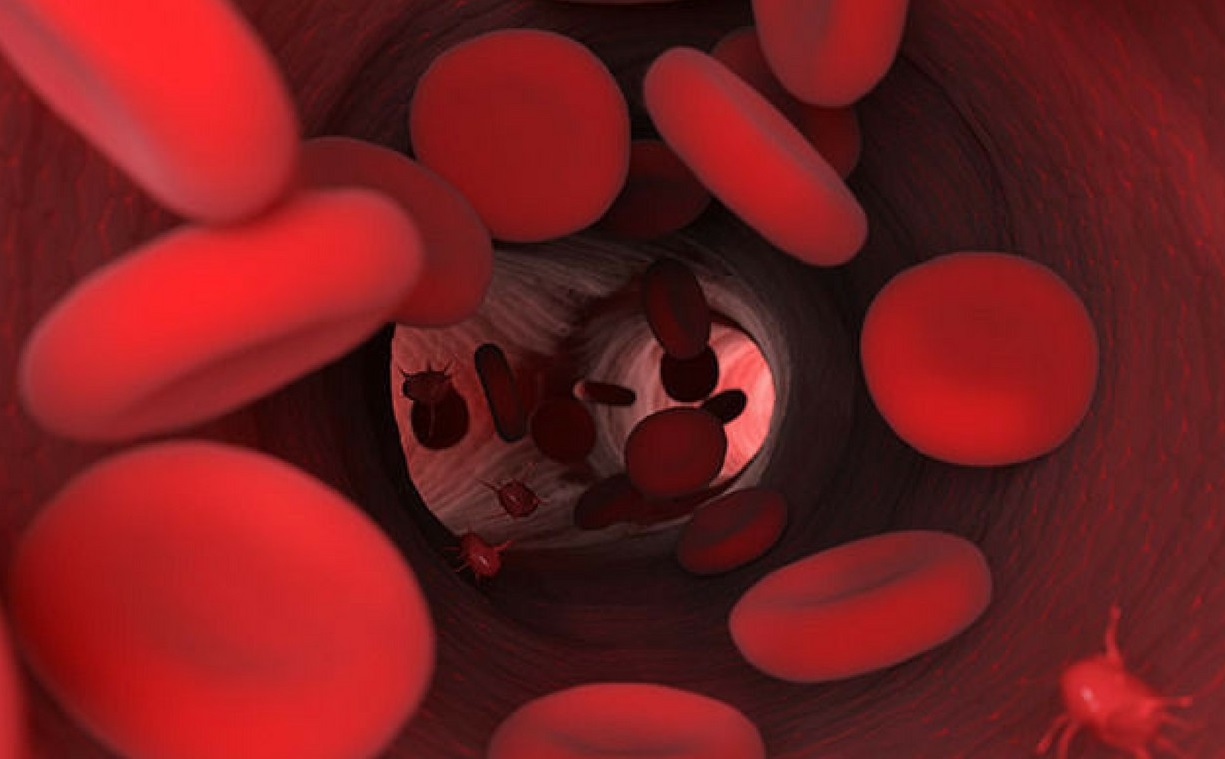 Vasculiti ANCA-associate: l'Ue ha approvato avacopan, in combinazione con un regime di trattamento a base di rituximab o ciclofosfamide