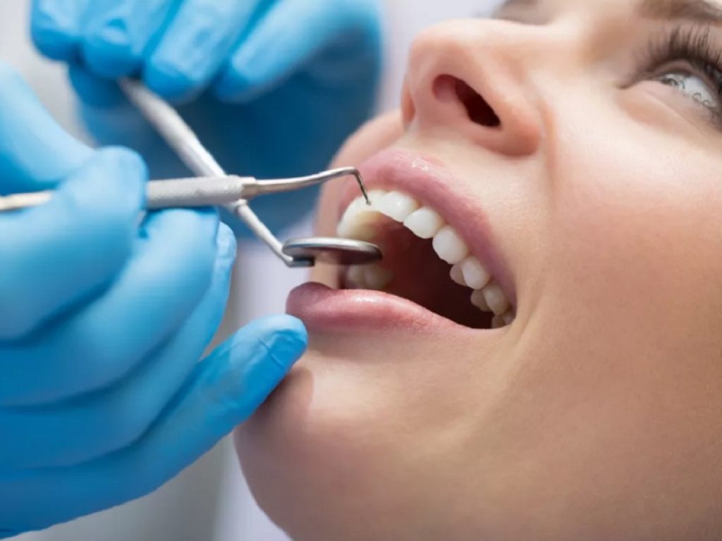 Lo sbiancamento dentale effettuato da un professionista permette di ottenere nuovamente il bianco e naturale colore dei denti