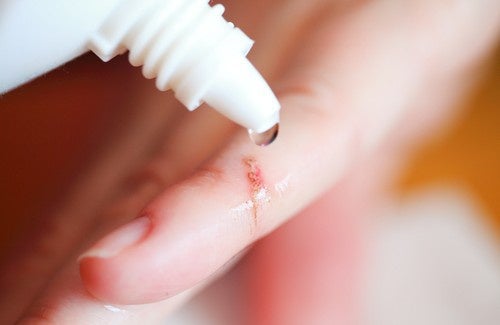 Ferite, ecco come bisogna disinfettarle nel modo giusto per evitare di peggiorare l’entità del danno e causare infezioni