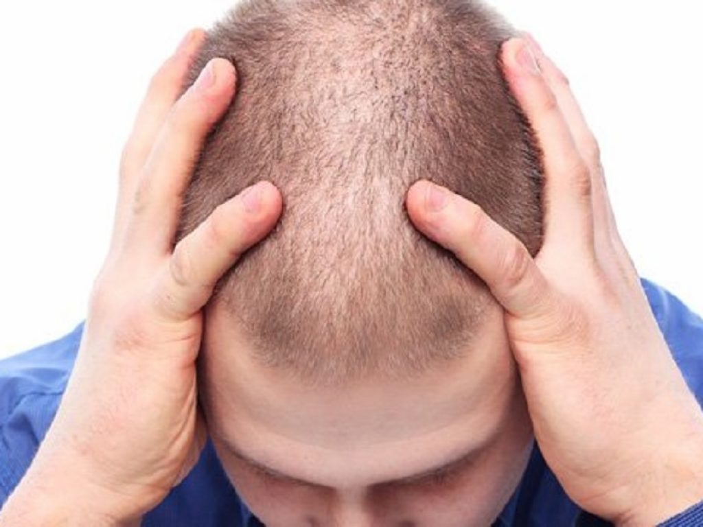 Sindrome post-finasteride: in Italia un’associazione di pazienti. Si chiama Associazione Vittime Finasteride e collabora, a livello internazionale, con la Post-Finasteride Syndrome Foundation (USA)