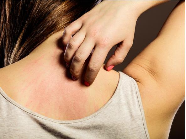 sindrome di alagille elafibranor