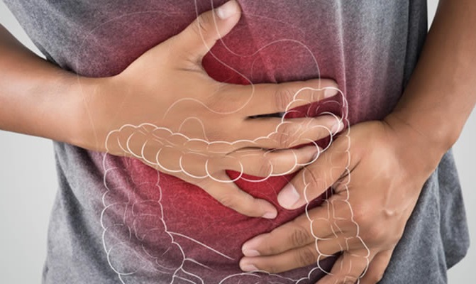 Colite ulcerosa: nuovi dati dimostrano un'efficacia sostenuta in un ampio intervallo di dosi misurate a 56 settimane di RVT-3101