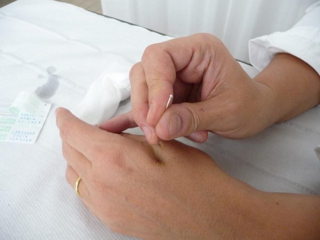 Agopuntura utilizzata su patologie ad elevato impatto sociale come cefalea e mal di schiena: trattamento efficace, sicuro ed economico