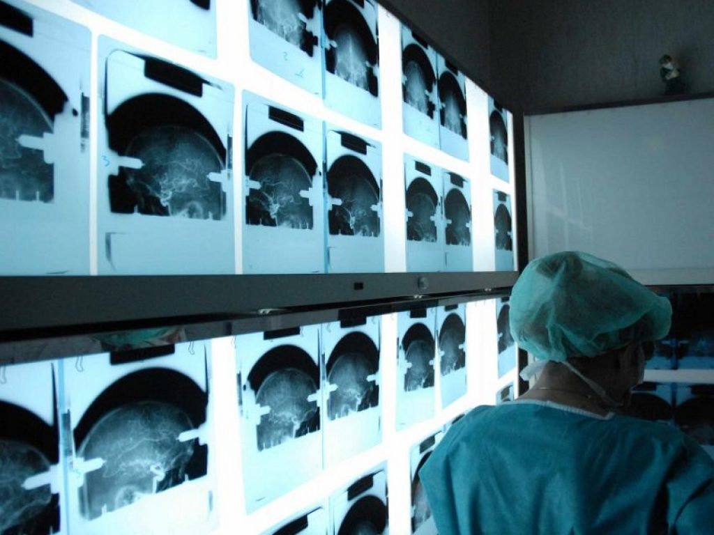 Emicrania cronica: la cura con somministrazione di tossina botulinica viene ripetuta una volta ogni 3 mesi, per una media di 4 cicli terapeutici l'anno