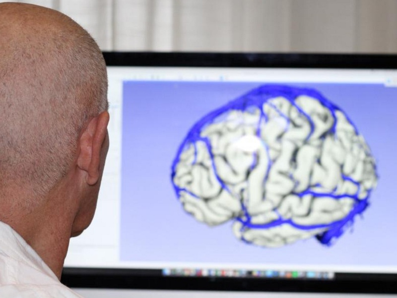 Da esperti italiani di Medicina Emergenza/Urgenza arriva il documento "Colpi di testa - L'importanza dei test diagnostici nell'individuazione del trauma cranico lieve"