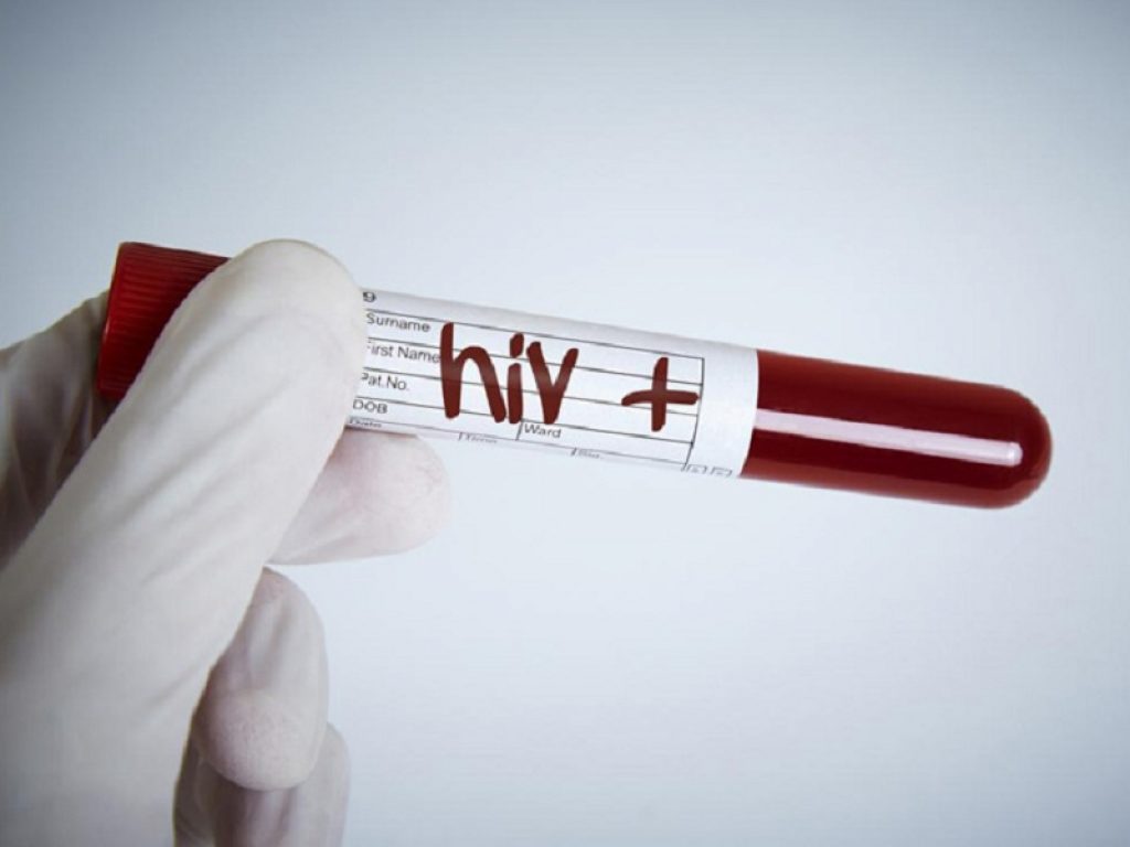 HIV: con il regime dolutegravir/lamivudina soppressione virale e sicurezza mantenute nel lungo periodo secondo due nuovi studi