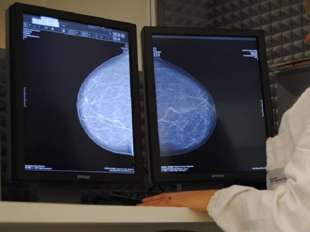 Tumore della mammella, arrivano i nuovi test: il 20% delle donne colpite dalla neoplasia può essere sottoposto alle analisi molecolari, che sono rimborsabili su tutto il territorio