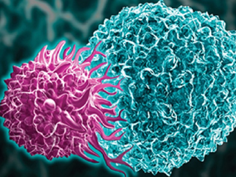 La leucemia a cellule capellute (LCC) (o tricoleucemia) è una forma di cancro del sangue rara e a crescita molto lenta: dal 1958 a oggi, i progressi della ricerca
