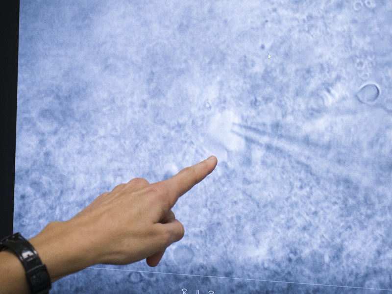 Epilessia: sviluppati nuovi outcome più informativi per valutare l'efficacia di brivaracetam in termini di durata di riduzione della frequenza delle crisi