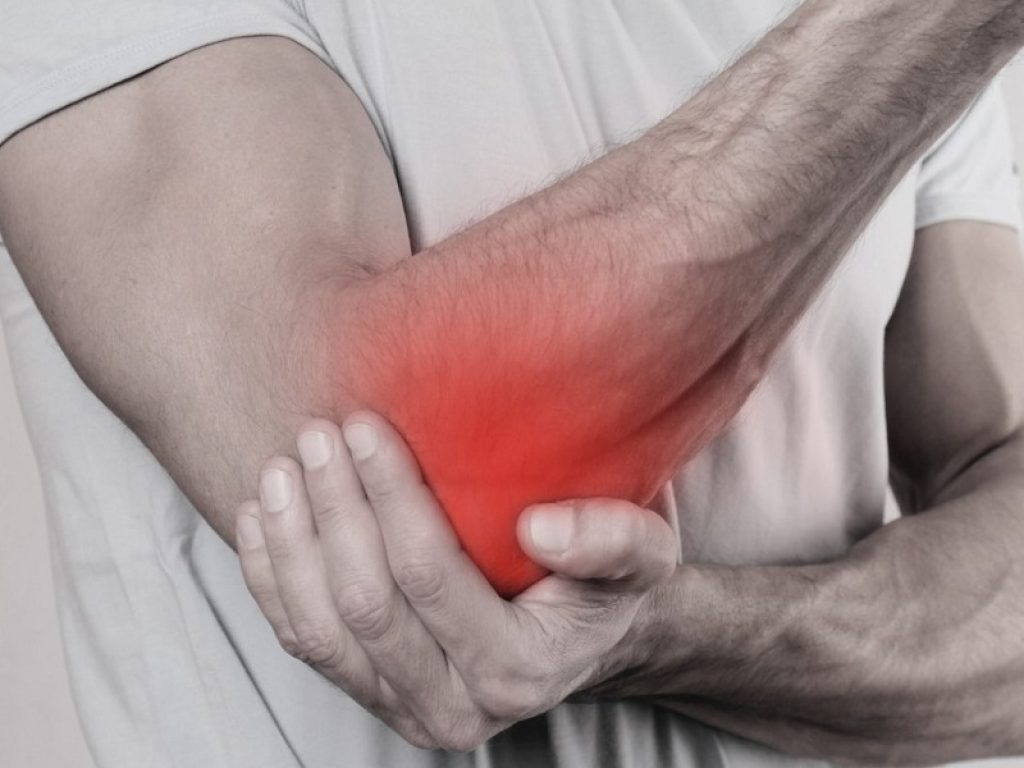 Il suo vero nome è epicondilite, ma per tutti è il gomito del tennista, un’infiammazione molto dolorosa che chi l’ha provata difficilmente può dimenticare. Per fortuna le terapie non mancano: esercizi, tutori, onde d’urto, farmaci e nei casi più estremi la chirurgia, tutto per ritornare a muovere il braccio con naturalezza. Ne parla lo specialista, il chirurgo della mano dell’Ospedale Niguarda. Il movimento articolare del gomito è dato dai muscoli che agiscono sulle leve ossee grazie ai tendini (vere e proprie corde che tirano). Nella parte distale dell’omero i tendini estensori del polso si inseriscono sul versante esterno (epitroclea) mentre i tendini flessori del polso si inseriscono sul versante interno (epitroclea). Nel gomito pertanto possono infiammarsi sia i muscoli estensori del polso (è l’epicondilite o gomito del tennista), sia i muscoli flessori del polso (è l’epitrocleite o gomito del golfista). L’origine di tale infiammazione è quasi sempre micro traumatica, dovuta a gesti atletici sportivi o lavorativi ripetuti. Se i tendini che servono per estendere il polso e le dita si danneggiano si inizia ad avvertire il dolore durante i movimenti. Il dolore si estende poi al braccio e in alcuni casi anche alla mano. Molto spesso si cerca di far fronte alla cosa utilizzando delle fasce elastiche (dei tutori) che attenuano il fastidio durante lo sforzo fisico. Ma quando questo non basta è necessario rivolgersi allo specialista: un ortopedico o un chirurgo della mano. Dopo la fase acuta l’epicondilite tende a cronicizzarsi arrivando ad una reazione cicatriziale: si tratta di un’infiammazione per cui il tendine e i muscoli perdono la loro elasticità, ed è questa condizione che provoca il dolore. Perciò la prima cosa da fare è molto stretching, per rielasticizzare il muscolo, accompagnato da riposo e ghiaccio. Il tendine e il muscolo interessati da epicondilite sono poco vascolarizzati per cui le terapie cercano di promuovere questo processo. Per farlo si utilizzano le onde d’urto o la laser-terapia. Poi c’è la mesoterapia:infiltrazioni sottocutanee che si eseguono con tanti aghi corti, utili per iniettare a livello superficiale, del derma, farmaci tradizionali, anti-infiammatori, o anche della medicina omeopatica. A seconda del caso si possono prescrivere delle classiche infiltrazioni in profondità a base di cortisonici. L’intervento si riserva per le forme più severe che non hanno beneficiato delle terapie (per almeno 6 mesi-1 anno), e viene praticato in anestesia loco-regionale ascellare, ed in regime di day hospital. Vi possono essere varie procedure chirurgiche, sia aperte sia artroscopiche, che vanno decise a seconda del caso. L’obiettivo è quello di liberare e tagliare la fascia superficiale e profonda muscolare, in modo da attenuare la tensione fibrotica; inoltre con delle micro-perforazioni nell’osso, si cerca di rivascolarizzare la regione epicondilare. Dopo l’intervento ci vogliono circa 2-3 settimane di riposo relativo, quindi si inizia con la fisioterapia: ginnastica e stretching per alcuni mesi, necessari per far riacquisire elasticità al tessuto.