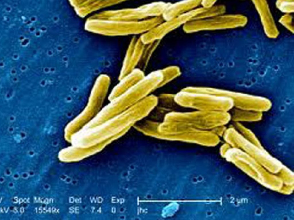 Vaccino antitubercolare più efficace con la somministrazione endovena anziché intradermica: lo hanno scoperto scienziati americani