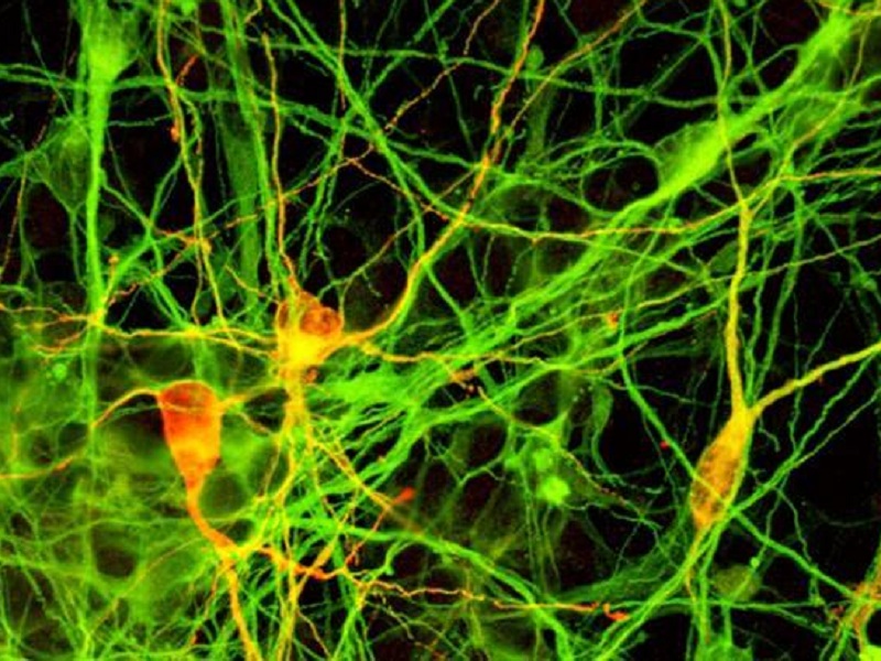 Nanoparticelle d’oro rallentano l’avanzare dell’atassia di Friedreich: studio ha scoperto che riducono il danno ossidativo e migliorano la funzionalità mitocondriale nei pazienti