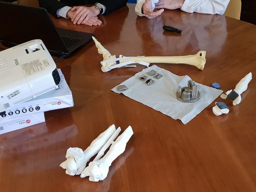 Al Rizzoli di Bologna la prima caviglia ricostruita con protesi 3D: è fatta su misura per il paziente, un'innovazione assoluta a livello mondiale