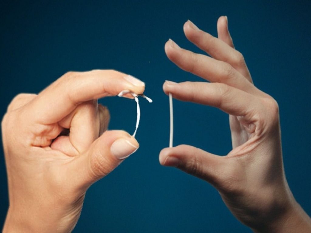 Contraccettivo Nexplanon, AIFA avverte: riferiti casi di danno neurovascolare e migrazione dell’impianto dal sito di inserimento nel braccio