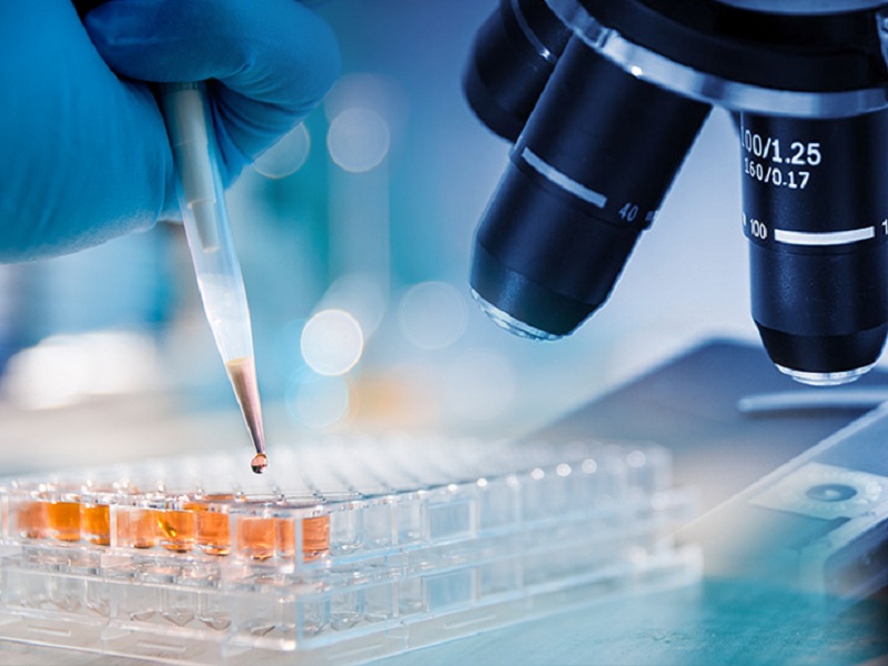 Linfoma a grandi cellule B: buoni risultati nei pazienti trattati con una singola infusione delle cellule CAR-T anti-CD19 axicabtagene ciloleucel (axi-cel) in seconda linea