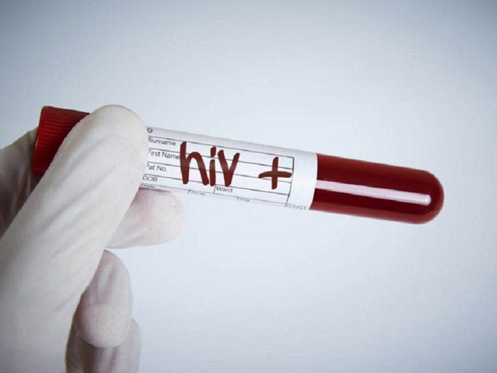 Hiv: l'inizio precoce della terapia antiretrovirale sembra normalizzare la durata della vita in presenza di un elevato numero di cellule CD4