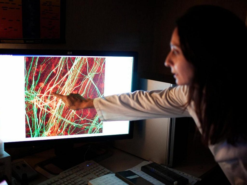 Sclerosi multipla secondariamente progressiva: confronto tra terapie a bassa e alta efficacia su ricadute e disabilità causata dalla SPMS