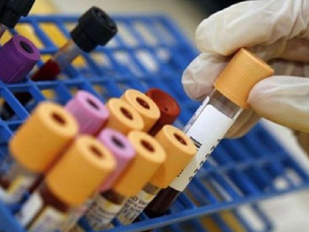 Studio indiano: il plasma convalescente derivato da pazienti guariti dal Covid non ha fornito alcun beneficio rispetto alle cure abituali in 464 pazienti adulti