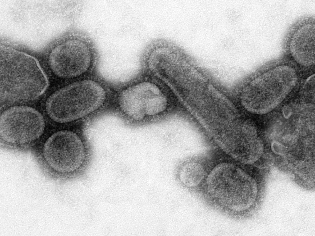 Non solo Coronavirus: dalla peste nera all'influenza Spagnola del 1918, dal colera all'Hiv ecco le più grandi pandemie della storia.