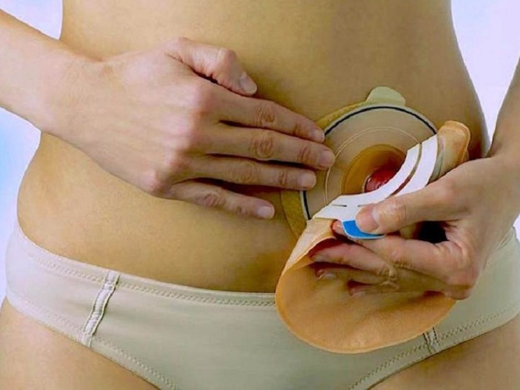 B. Braun lancia la prima web app sviluppata come dispositivo medico CE per migliorare la vita delle persone con stomia