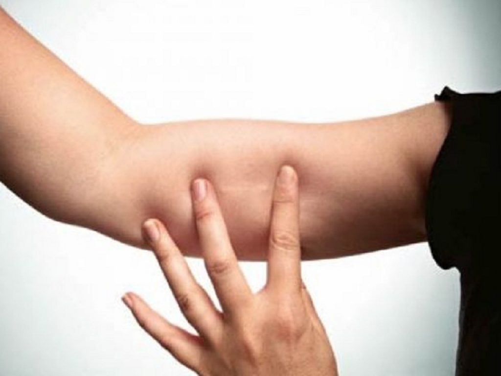 Metodi contraccettivi: il bastoncino sottocutaneo lungo 4 centimetri è la nuova frontiera degli anticoncezionali. Ecco come funziona e quanto dura